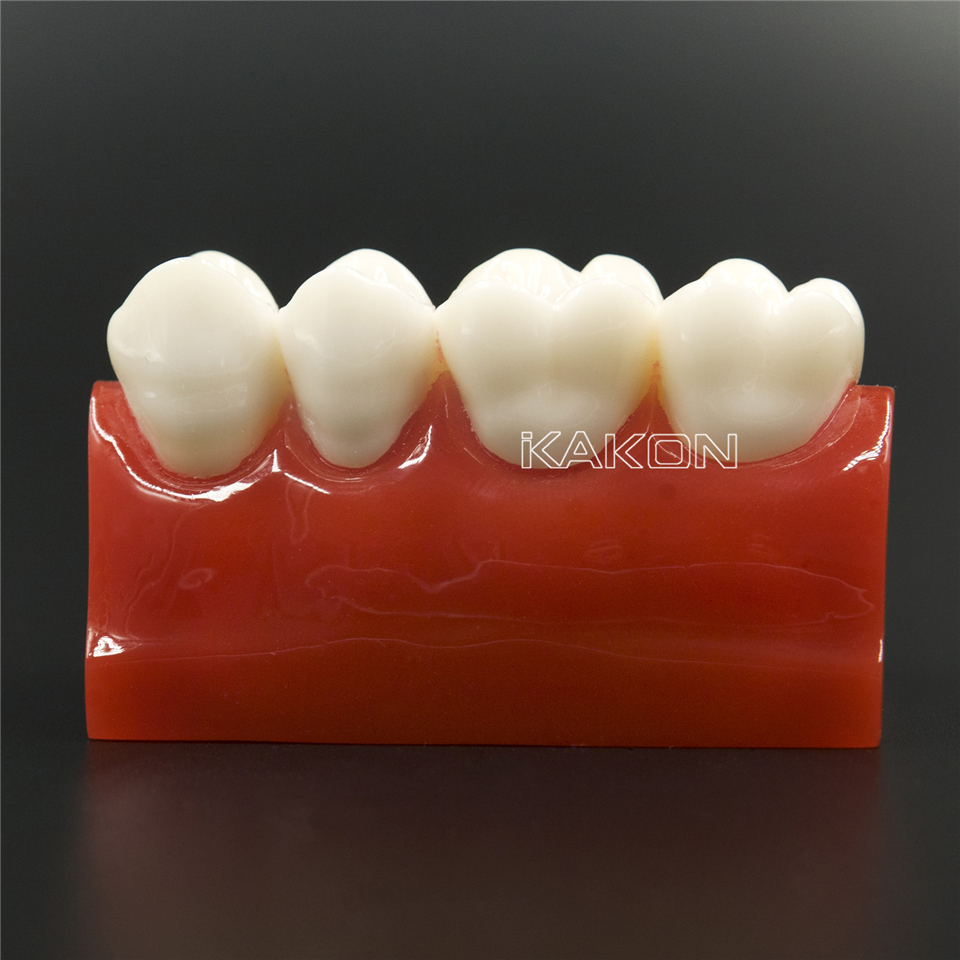 Dental Cavity Sealing Demonstration tooth Model teeth study