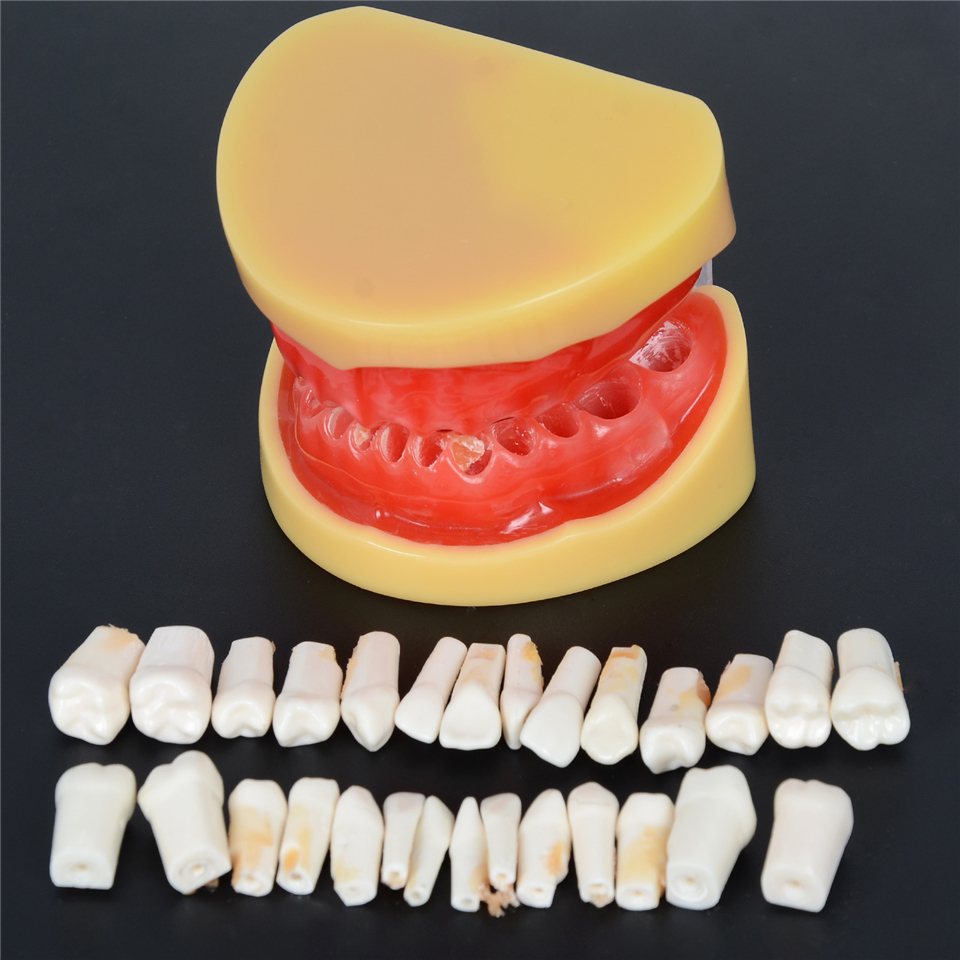 Dental All Removable Standard Teeth Tooth Model 28 pcs teeth